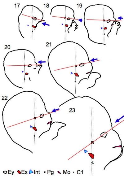 Hearing - Outer Ear Development - Embryology