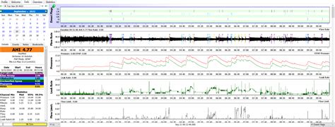 HELP ! i have severe AHI, this is my average night ... any advise ? : r ...