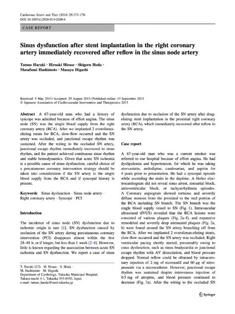 Sinus Node Dysfunction and Ischemia | PDF