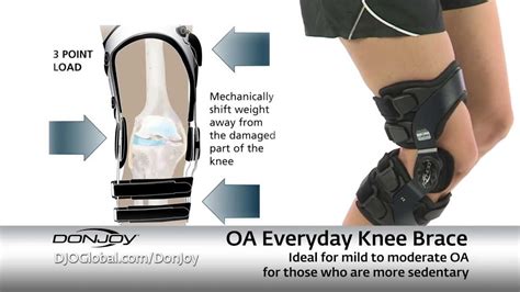 DonJoy Osteoarthritis Knee Braces | vlr.eng.br