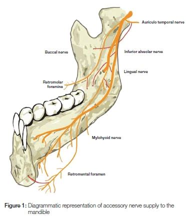 Long Buccal Nerve Block