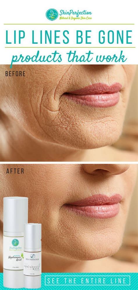 Lip lines are a natural part of the aging process but they can be ...