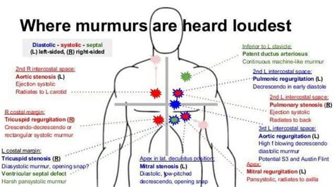 This picture will help you understanding heart murmur - MEDizzy