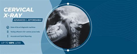 Cervical X-ray - Aarthi Scans and Labs