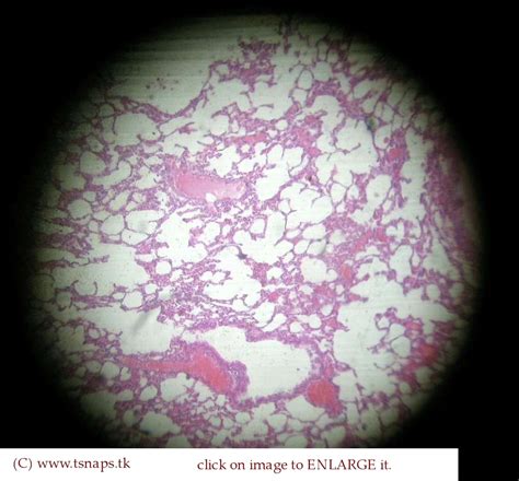 Histology Slides Database: lung histology slide