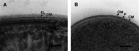 Electron microscopical comparison of the gram-negative cell envelopes... | Download Scientific ...