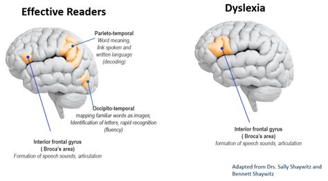 Dyslexia Resources — RISE