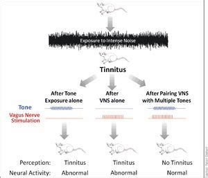 Vagus Nerve Stimulation Helps Resolve Tinnitus in Rat -- Health ...