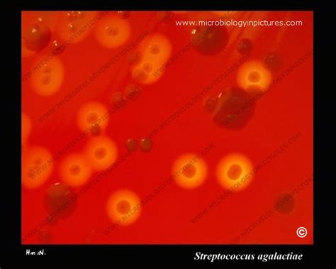 Streptococcus agalactiae in a mixed culture with nonhemolytic colonies. S.agalactiae hemolytic ...