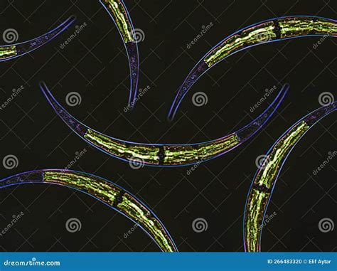 Closterium Sp. Charophyta Algae Under Microscopic View X40, Green Algae, Dark Background Stock ...