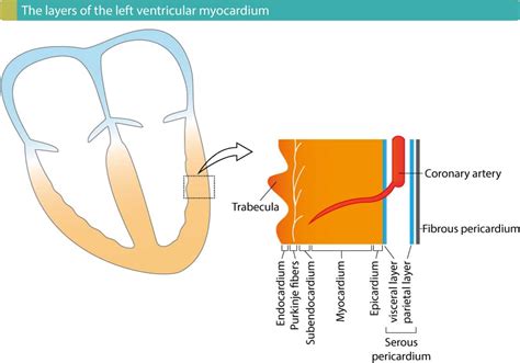 Figure 3. NSTE-ACS (Non-STEMI) is caused by a partial occlusion, which means that there is some ...