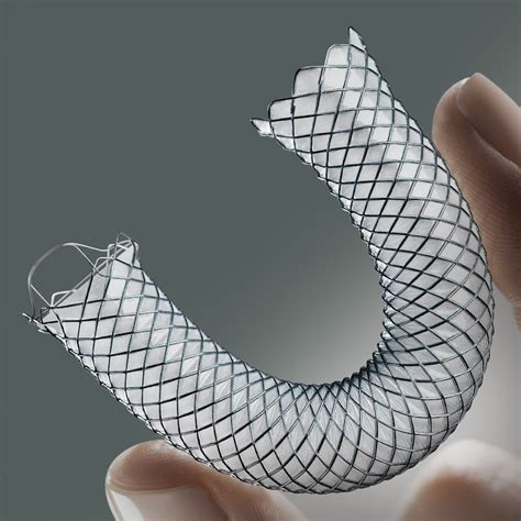 New stents deal to end agony of throat cancer patients