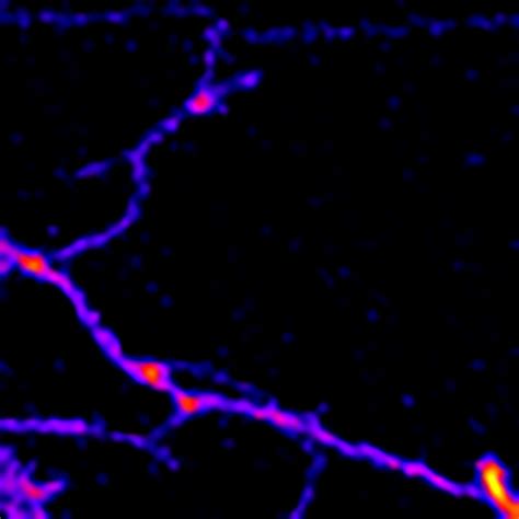 Principles and applications of fluorescence microscopy - France-BioImaging