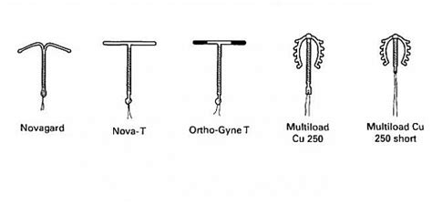 Copper T Side Effects, Copper T Insertion, Removal. Types, Images and ...