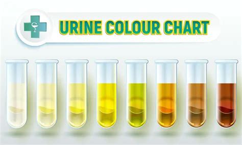 What Your Urine Says About Your Health