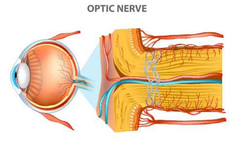 Optic Neuropathy: Do You Know the Signs? - Atlanta Eye Care