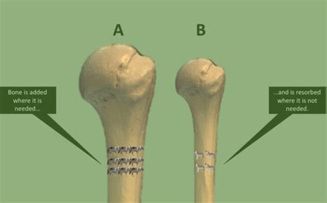 What is Wolff’s Law and How is it Related to Posture and Musculoskeletal Health - The Frisky