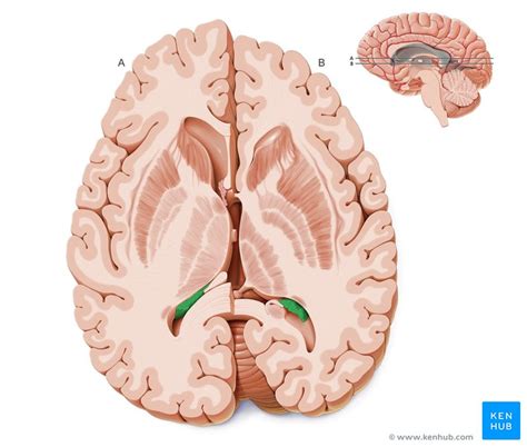 Choroid plexus: Anatomy, histology and clinical aspects | Kenhub