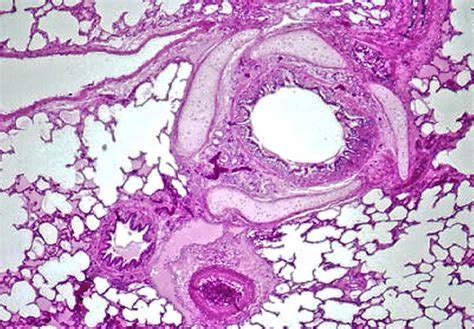 Respiratory System Histology Slides