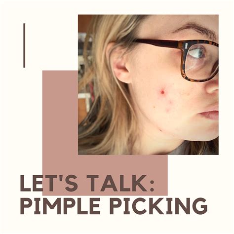 Let's Talk: Pimple Picking