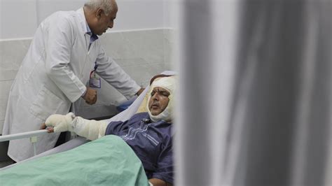 In Gaza, living conditions increase the risk of burns - Teller Report