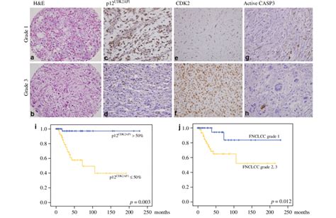 High FNCLCC grades (2, 3) and low (B50 %) p12 CDK2AP1 protein level... | Download Scientific Diagram