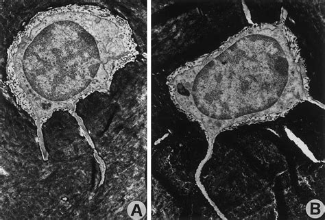 Transmission electron microscopy (14,000) micrographs of osteocytes... | Download Scientific Diagram