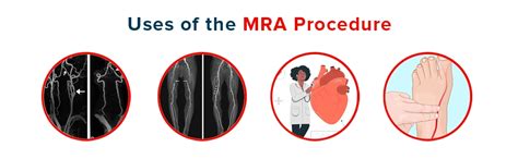 MRA: Uses, Risks, Preparation and Procedure | MRA and MRI