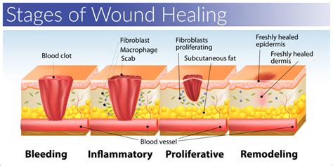 Why your scar tissue isn’t an issue | Biomechanics in the Wild