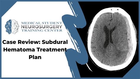 Case Review: Subdural Hematoma Treatment Plan - YouTube