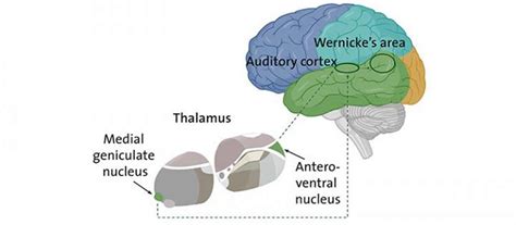 Schizophrenia: When the thalamus misleads the ear - Neuroscience News