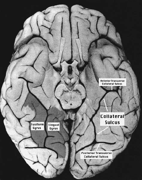 Ventral Brain Anatomy