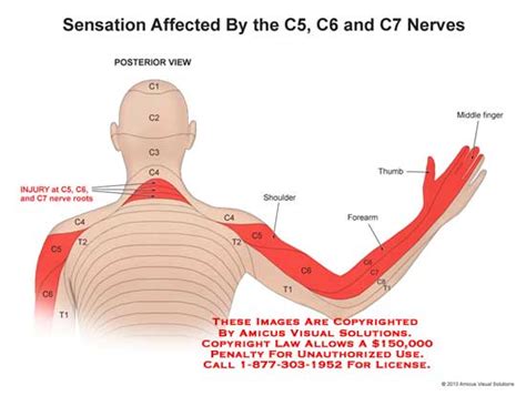 (13128_04X) Sensation Affected by the C5, C6, and C7 Nerves – Anatomy ...