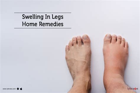 10 Causes For Swollen Feet Why Your Feet, Ankles, Legs Swell | lupon.gov.ph