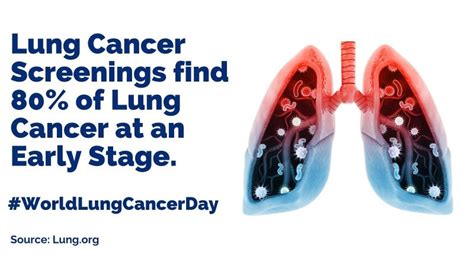 Oncocyte Corporation on LinkedIn: #worldlungcancerday #cancerscreening ...