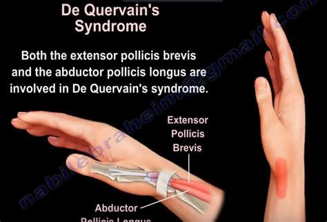 Anatomy of #Extensor Pollicis Brevis — OrthopaedicPrinciples.com