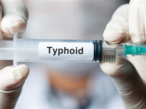 Typhoid Fever: Causes, Symptoms, Diagnosis, Treatment, and Management