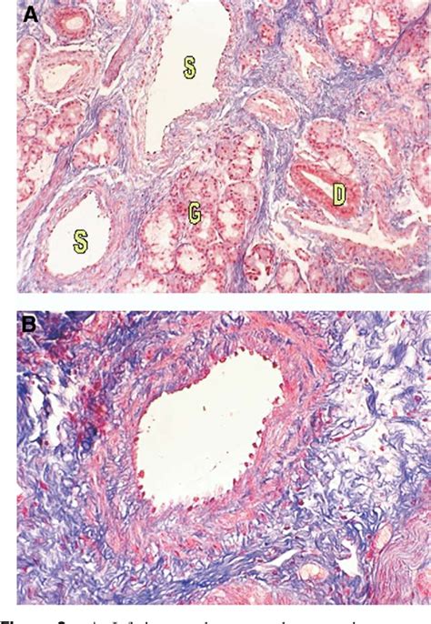 Histology of the Nasal Septal Swell Body (Septal Turbinate) | Semantic Scholar