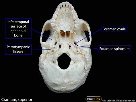 S9 Infratemporal Fossa - Learning Objectives - BlueLink