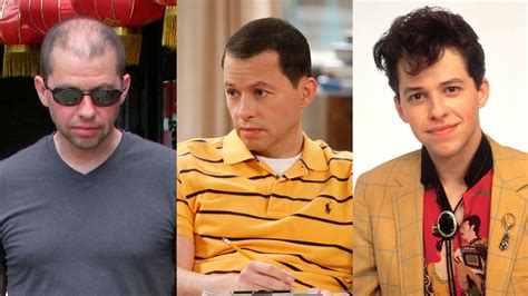 Chatter Busy: Jon Cryer Hair Transplant