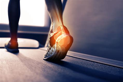 What are the Most Common Foot Injuries in Sports?