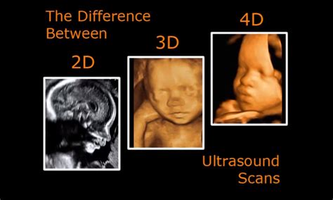 What Is The Difference in 2D,3D & 4D? - Fetal Flix : Fetal Flix