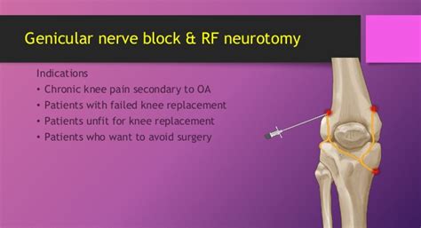 BLOG on Orthopedic Spine Surgery and Interventional Pain Management Practice Coding, Billing ...