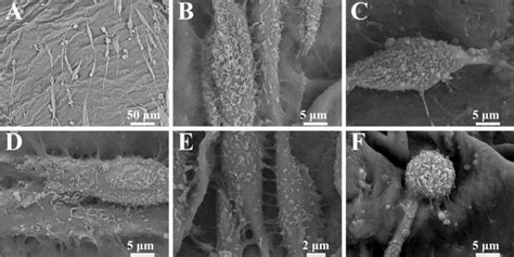 SEM images of stromal cells cultured on BC. a Stromal cells grew ...