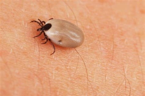 87 best ticks on humans images on Pinterest | Lyme disease, Ticks and ...