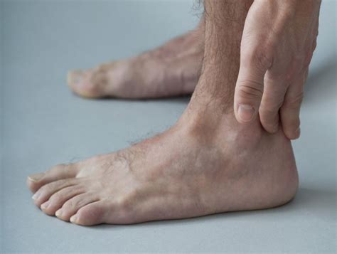 Tendonitis of the Foot and Ankle - Causes and Treatment