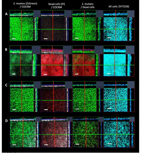 Images showing biofilms and localization of S. mutans on hydroxyapatite ...