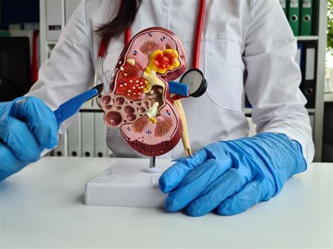 Surgeon in Glove Holds Scalpel and Anatomy of Kidney Stock Photo ...