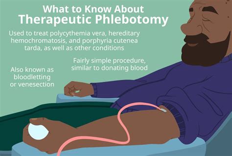 Therapeutic Phlebotomy: Benefits, Risks, and Treatment Tip