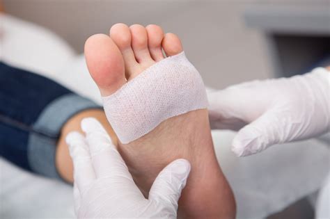 Pin on Common Foot Ailments